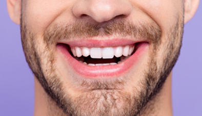 Beckenham Smiles Dental Checkup