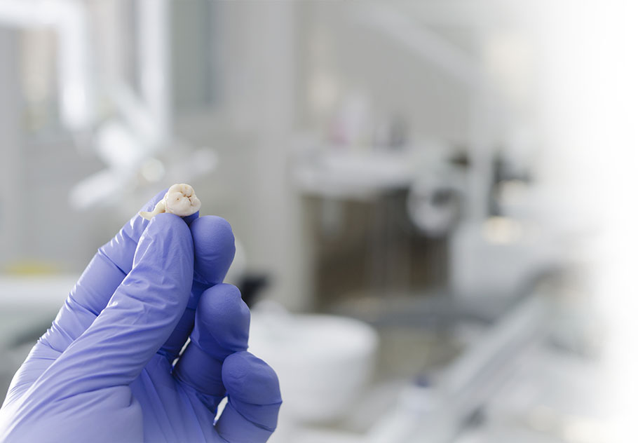 Surgical Extraction Beckenham