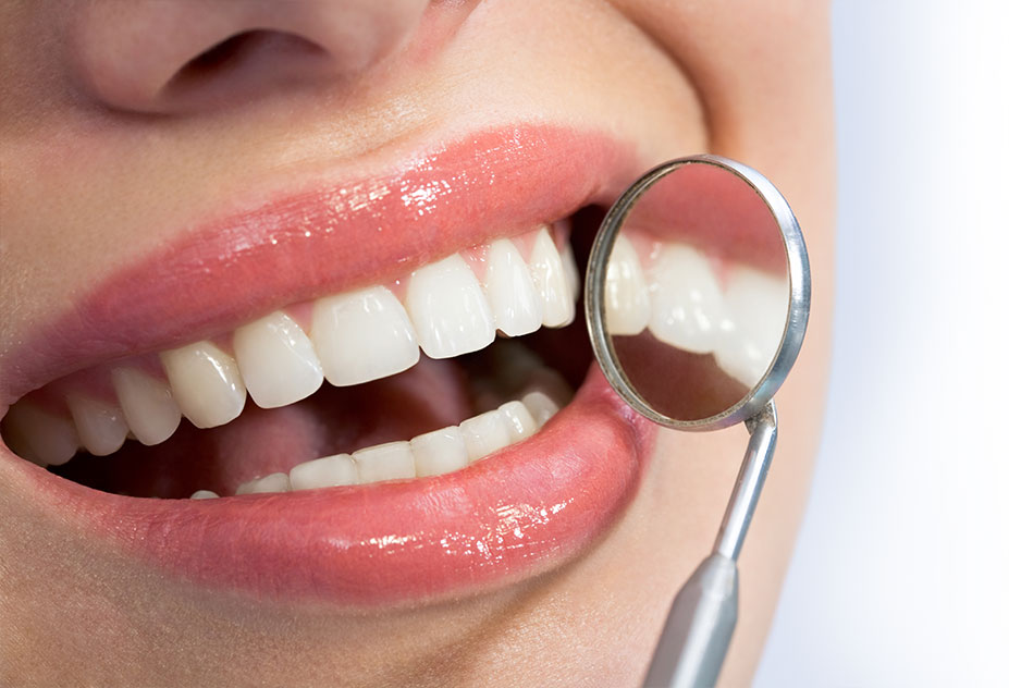 White Fillings Beckenham