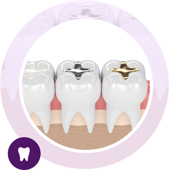 White Fillings in Beckenham