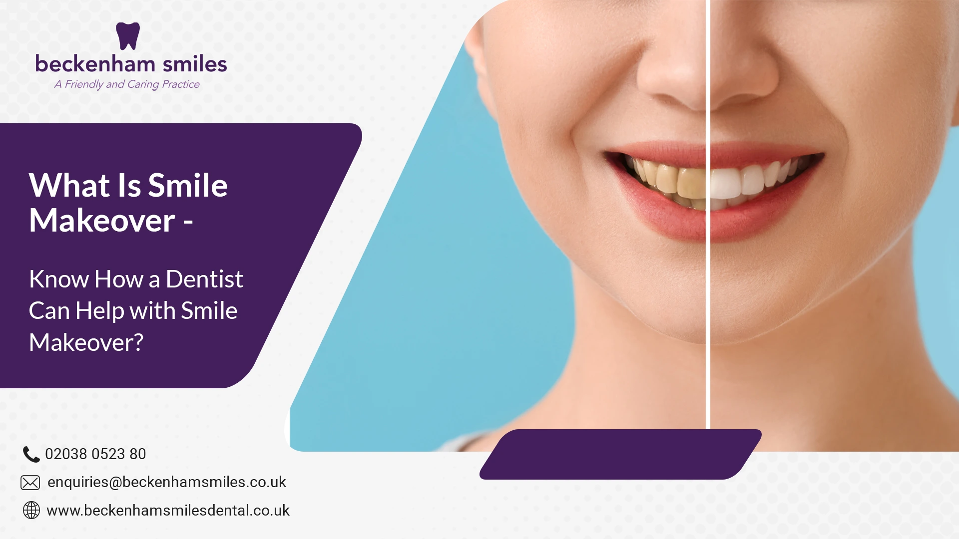 smile-makeover