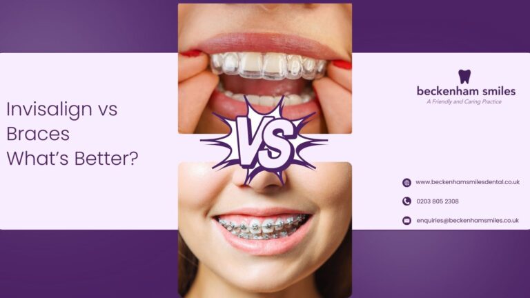 Invisalign vs Braces in Beckenham
