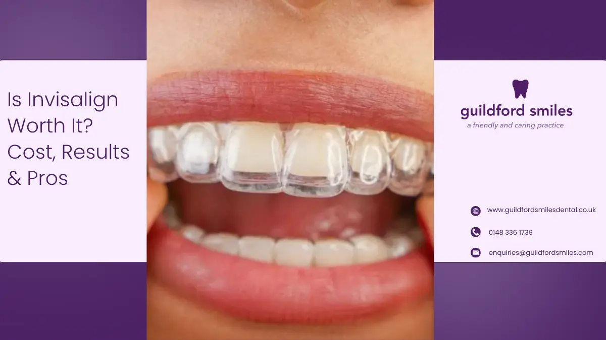 Is Invisalign Worth It in Guildford? Cost, Results, Pros and Real Expectations – 2026 Guide