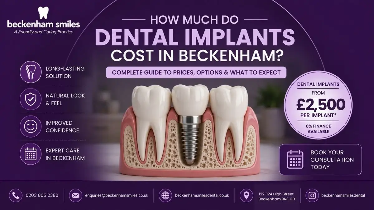Affordable dental implant costs in Beckenham for replacing missing teeth with long-lasting implants.