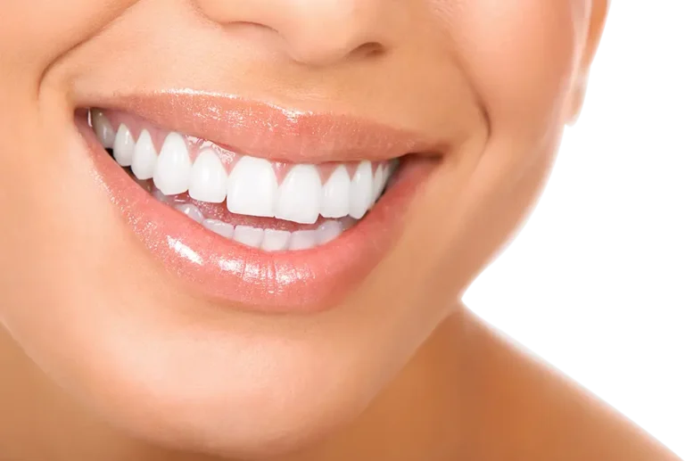 Teeth Whitening in Beckenham