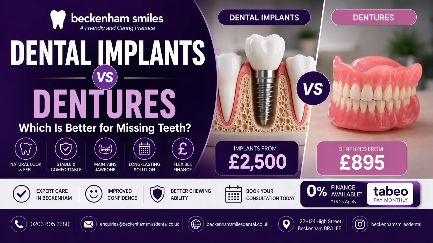 dental-implants-vs-dentures-backenham