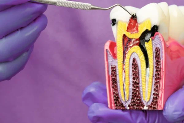 general-dentistry-common-dental-problems-beckenham-treats