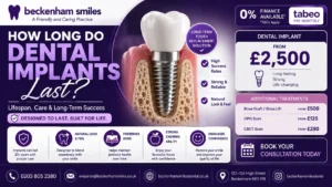 how-long-do-dental-implants-last