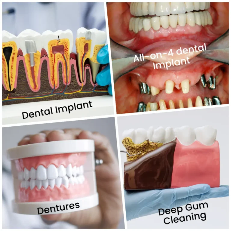 Specialist dentistry and advanced dental treatments for patients near Elmers End at Beckenham Smiles Dental